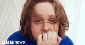 Lewis Capaldi: How success affected his mental health