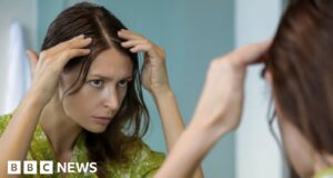 Cause of grey hair may be ‘stuck’ cells, say scientists