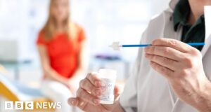 NHS Scotland calls 13,000 women for smear tests after error