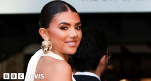 Love Island star Samie Elishi gets cancer check after fans spot lump