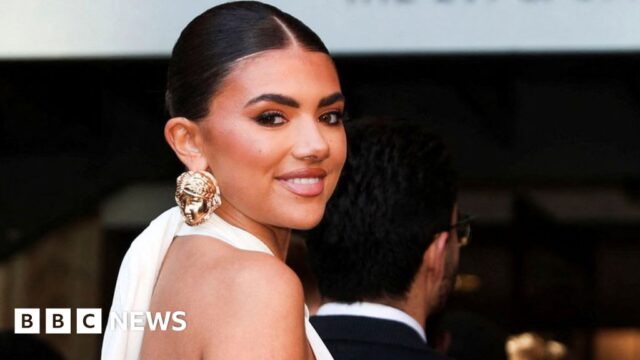 Love Island star Samie Elishi gets cancer check after fans spot lump