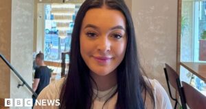 Lip fillers: Call for tighter regulation after botched treatments